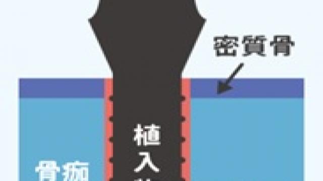 article_pic